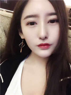 自體耳軟骨隆鼻果圖片展示和案例分享