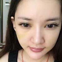 面部面b提升恢復(fù)日記和恢復(fù)圖片，一周左右恢復(fù)自然