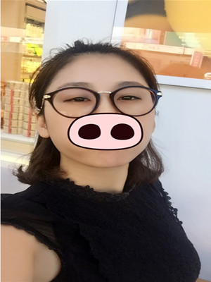 注射瘦臉去眉間紋真實案例分享——海口紅妝李科醫(yī)生做的