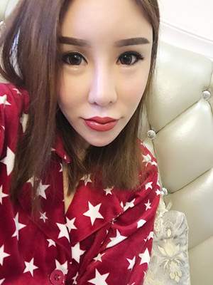 高強度聚焦超聲手術(shù)三個月的前后恢復(fù)記錄——?？诩t妝李科做的