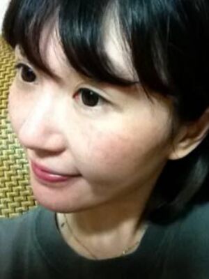 激光去雀斑果好不好，真實(shí)案例告訴你
