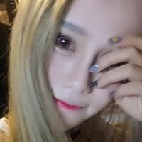 玻尿酸填充臥蠶果對(duì)比圖，很滿意