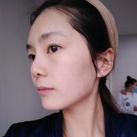做完光子嫩膚恢復(fù)圖片和過(guò)程分享，光子嫩膚價(jià)格3800元