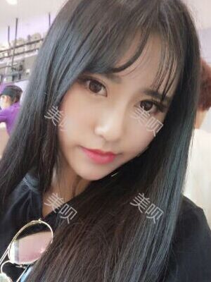 線D隆鼻恢復(fù)過程圖片，真實案例照片