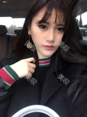 線D隆鼻恢復(fù)過程圖片，真實案例照片