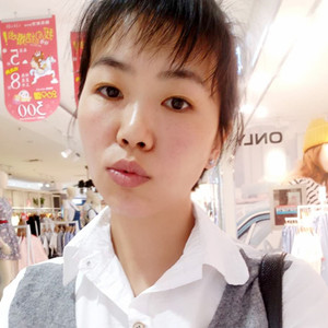 激光祛曬斑真實案例分享，并附上前后對比圖片