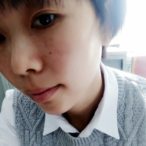 激光祛曬斑真實案例分享，并附上前后對比圖片