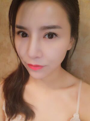 臉部埋埋蛋白線.提升果圖，真實經(jīng)歷分享