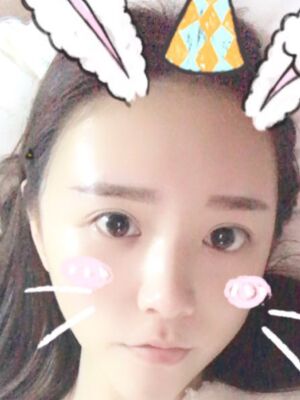 自體脂肪詳細部填充日記，恢復(fù)過程分享