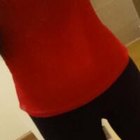 吸脂減肥瘦腰腹不反彈，恢復(fù)過(guò)程圖分享