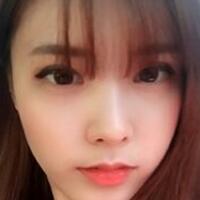 做了割雙眼皮和開內(nèi)眼角雙眼皮多項整形整形手術(shù)，恢復(fù)圖片日志分享