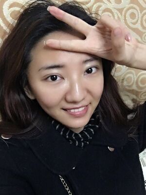 激光祛痘恢復(fù)過程圖，福州愛美爾做的喲