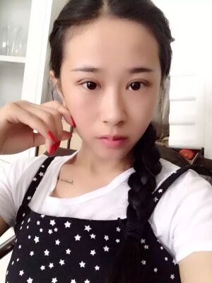 福州美貝爾切開(kāi)雙眼皮成功案例前后對(duì)比圖