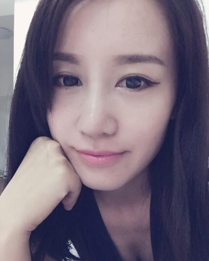 哈爾濱假體隆鼻價(jià)格8900元，隆鼻真實(shí)案例分享