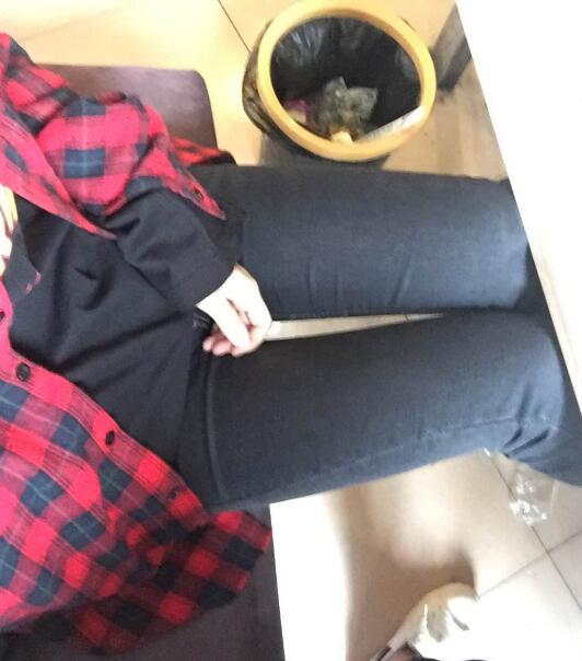 吸脂塑身醫(yī)院推薦歐蘭仁美醫(yī)院,吸脂瘦腿恢復(fù)圖分享