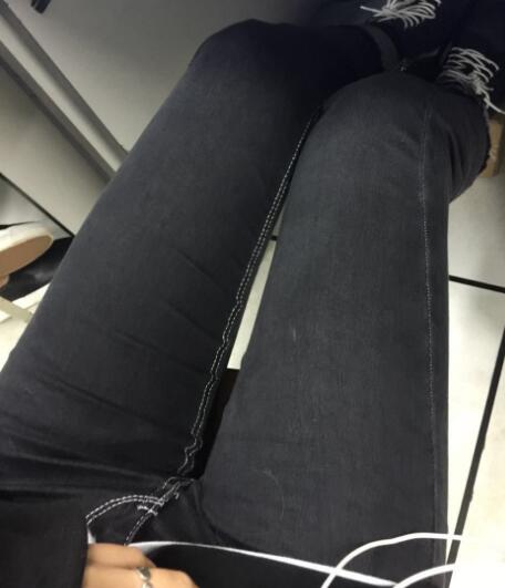 吸脂塑身醫(yī)院推薦歐蘭仁美醫(yī)院,吸脂瘦腿恢復(fù)圖分享