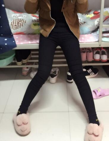 吸脂塑身醫(yī)院推薦歐蘭仁美醫(yī)院,吸脂瘦腿恢復(fù)圖分享