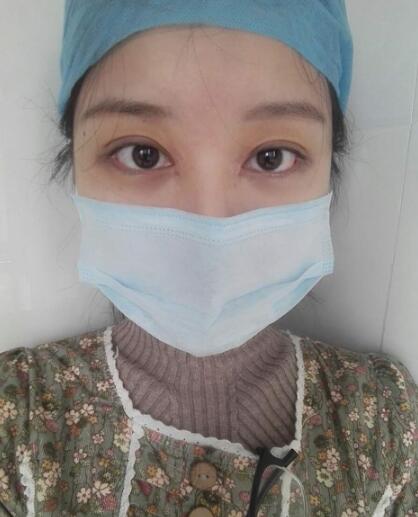 見證全切雙眼皮使單眼皮變雙眼皮的奇跡~恢復(fù)過程圖分享