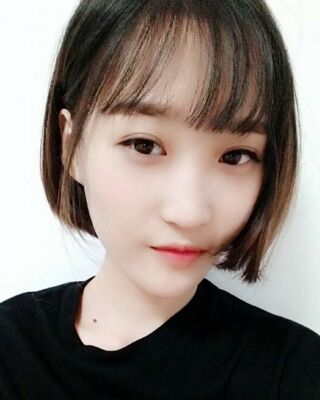 微創(chuàng)全切雙眼皮果對比照片，貴陽麗都葛志鑫手術(shù)案例