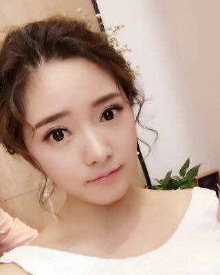 全切微創(chuàng)雙眼皮恢復(fù)圖，長(zhǎng)沙希美蔣松林手術(shù)案例