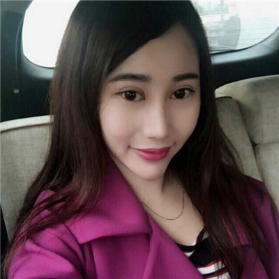 綿陽朗睿趙波做的切開雙眼皮，分享恢復過程和前后對比果圖片~