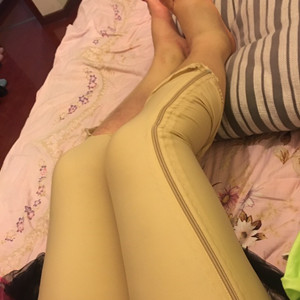 青?？等A馮相周醫(yī)生大腿抽脂案例分享