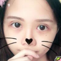 切開(kāi)雙眼皮+開(kāi)眼角前后對(duì)比圖和恢復(fù)過(guò)程分享