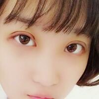 切開(kāi)雙眼皮多少錢(qián)？割雙眼皮真實(shí)案例多對(duì)比圖分享