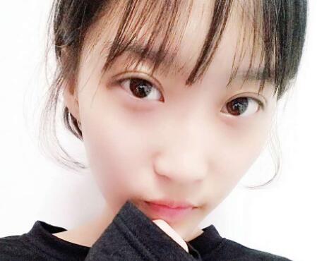 切開雙眼皮多少錢?割雙眼皮真實案例多對比圖分享