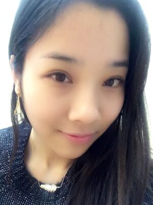 洛陽孔繁榮切開雙眼皮+開眼角手術(shù)恢復(fù)過程圖