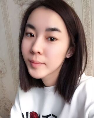 自體脂肪面部填充三個月果圖分享，減齡十歲