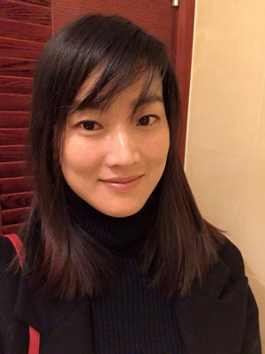 濟南愛容路傳燕醫(yī)生做的激光去黃褐斑，大家快來看看果如何