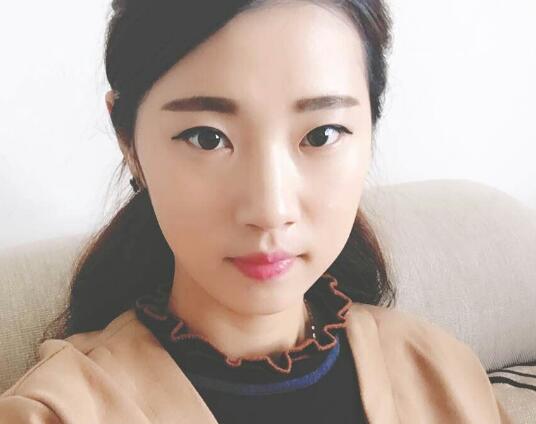 開眼角+割雙眼皮真實(shí)案例前后對(duì)比圖分享——四川悅好整形