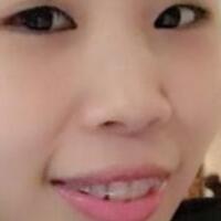 牙齒矯正的適宜年齡，多對比圖真實案例分享——成都格林口