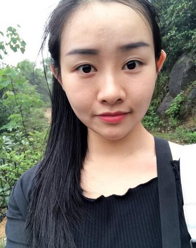 武漢樂美韓式微創(chuàng)雙眼皮+開內(nèi)眼角