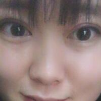 割雙眼皮前后對(duì)比圖和恢復(fù)過程——成都魅麗經(jīng)緯整形醫(yī)院