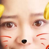 割雙眼皮前后對(duì)比圖和恢復(fù)過程——成都魅麗經(jīng)緯整形醫(yī)院