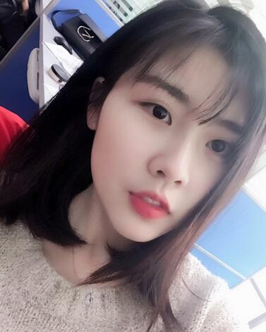 武漢西嬋康美玻尿酸隆鼻恢復(fù)過程圖