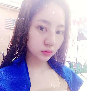 隆鼻整形前后對比圖和恢復過程