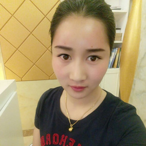 武漢美都張召醫(yī)生做的自體脂肪豐額頭+太陽穴，真實案例分享