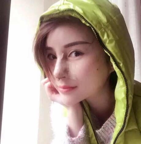 在南京明基醫(yī)院做的鼻子綜合整形手術價格14500元