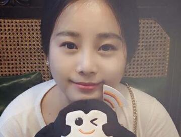 隆鼻整形價(jià)格和真實(shí)恢復(fù)期圖片