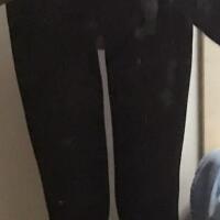 光纖溶脂瘦大腿有的方法真實(shí)案例分享——西安瑞麗整形