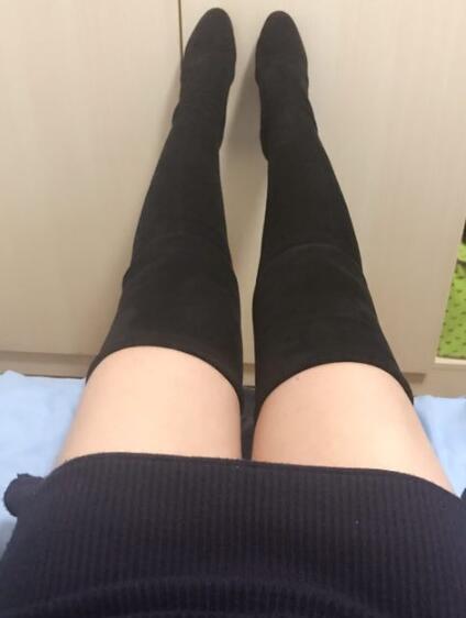 吸脂減肥瘦大腿前后對比圖，光纖溶脂瘦大腿較有的方法真實案例