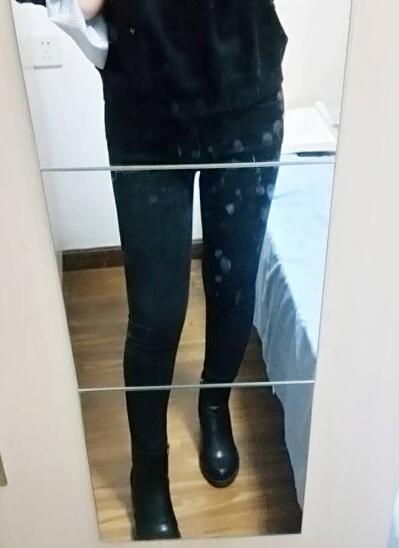 吸脂減肥瘦大腿前后對比圖，光纖溶脂瘦大腿較有的方法真實案例