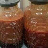 水動(dòng)力吸脂瘦大腿真實(shí)案例多對(duì)比圖經(jīng)歷——西安瑞麗整形