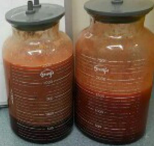 吸脂瘦大腿前后對比圖，水動力吸脂瘦大腿真實案例多對比圖經歷