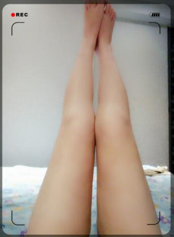 吸脂瘦大腿前后對比圖，水動力吸脂瘦大腿真實案例多對比圖經歷