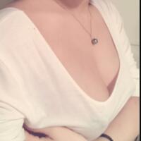 西安瑞麗整形美容醫(yī)院做的自體脂肪隆胸 整形案例分享