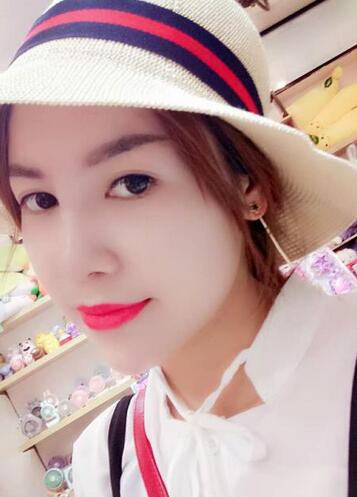 隆鼻整形一個(gè)月恢復(fù)期圖片 武漢壹加壹隆鼻整形案例